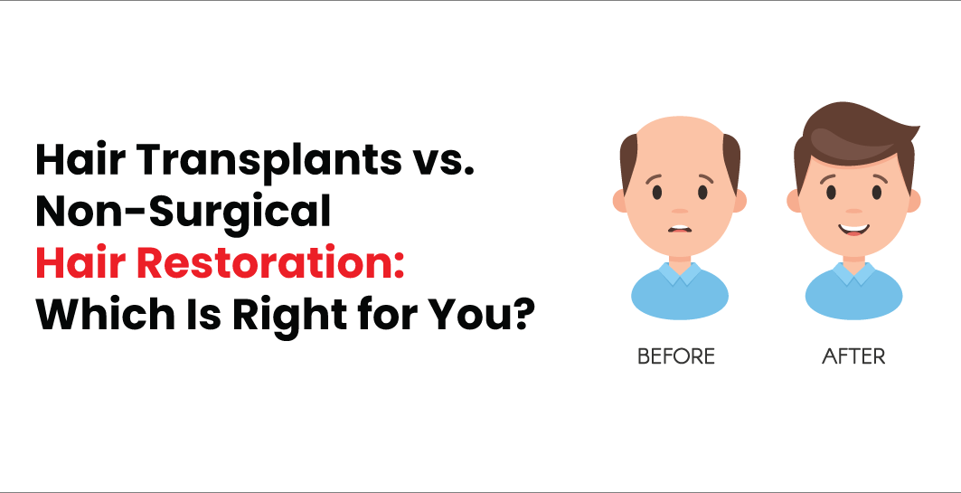 Hair Transplants vs. Non-Surgical Hair Restoration