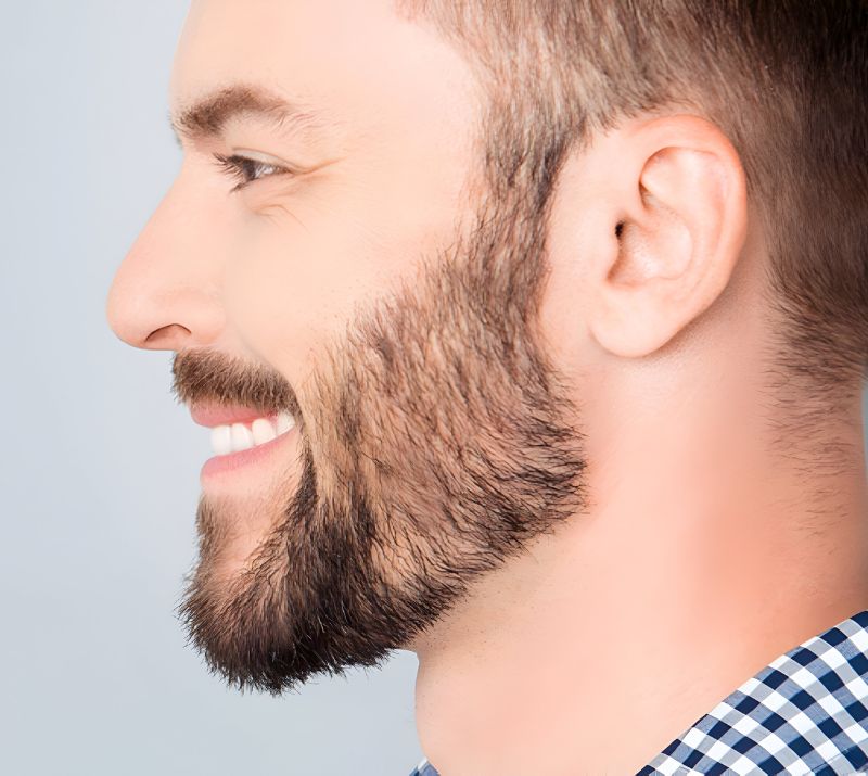 Facial Hair Transplants for a Bold Look