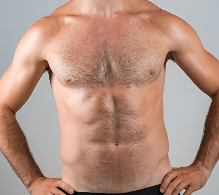 Sculpt Your Confidence with Male Chest Fat Reduction